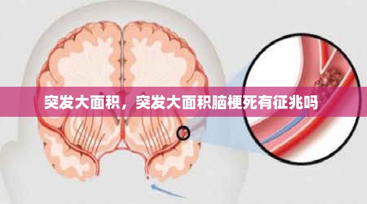 突发大面积,突发大面积脑梗死有征兆吗